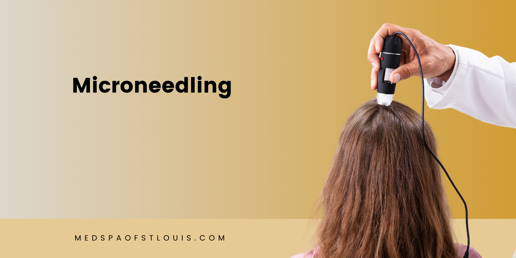Unlocking the Secrets of Microneedling in St. Loius: Does It Really Work?